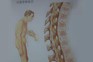 u=3406179898,144162084&fm=21&gp=0.jpg
